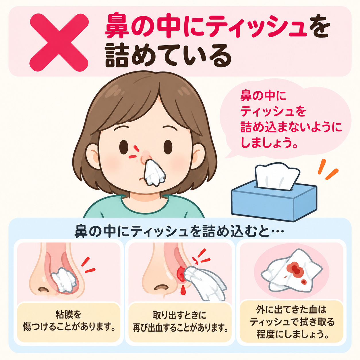 鼻の中にティッシュを詰め込んでいる間違った鼻血への対応