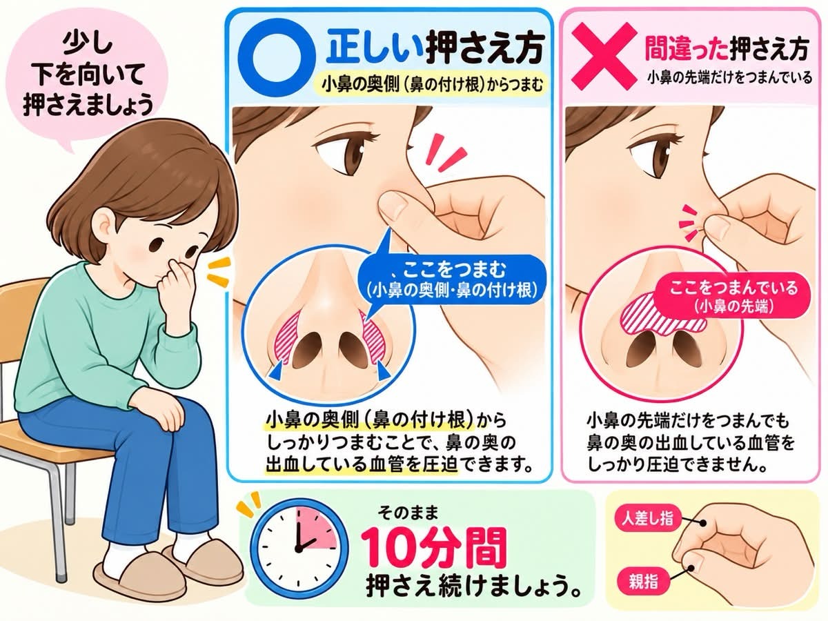 椅子に座って少し下を向き、片手の親指と人差し指で小鼻を押さえている正しい鼻血の止め方